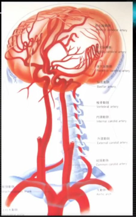 Anterior cerebral artery infarction, middle artery infarction...Super interpretation of MRI clinical features