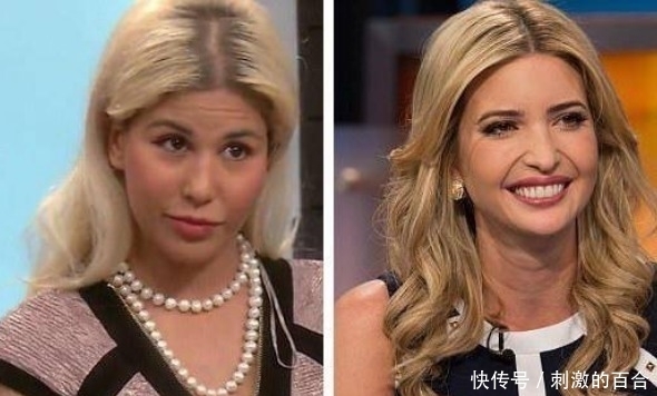 整容|女子花重金整容,一年经历13次整容手术,整容前后判若两人