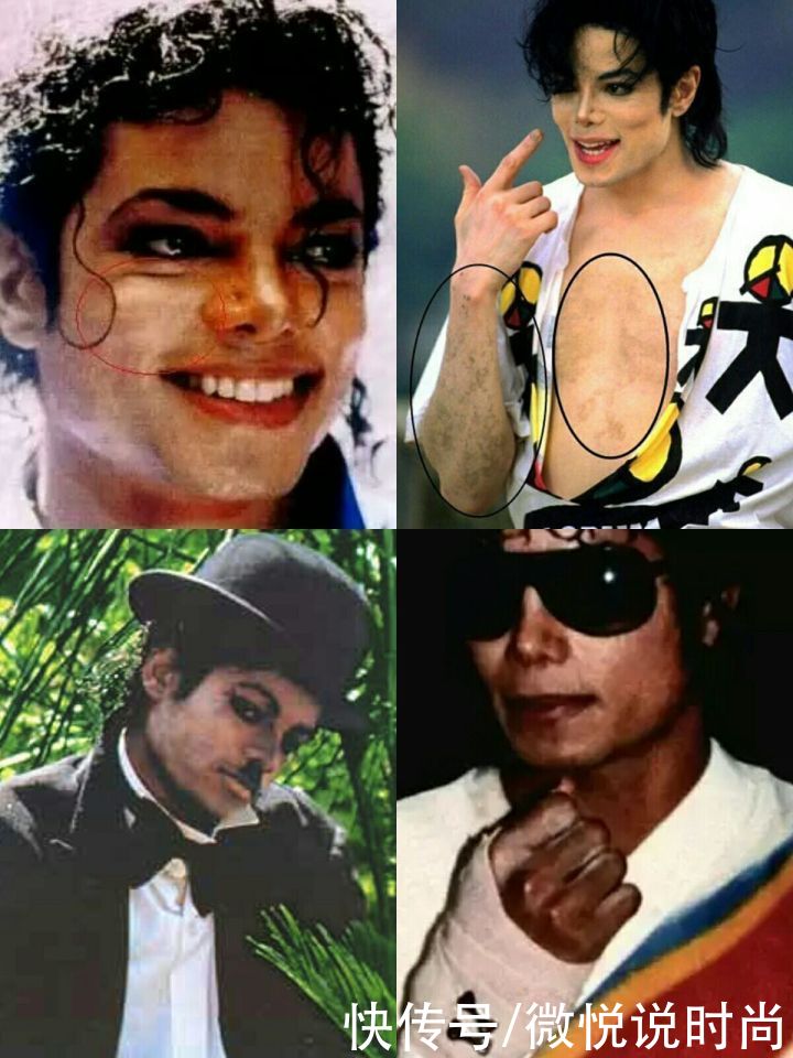 护肤品|熊果苷的护肤品真的可以美白吗