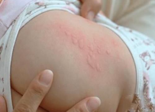 男婴|一岁男婴肚子被“抠”出血,邻居的悄悄话,让宝妈泪流满面