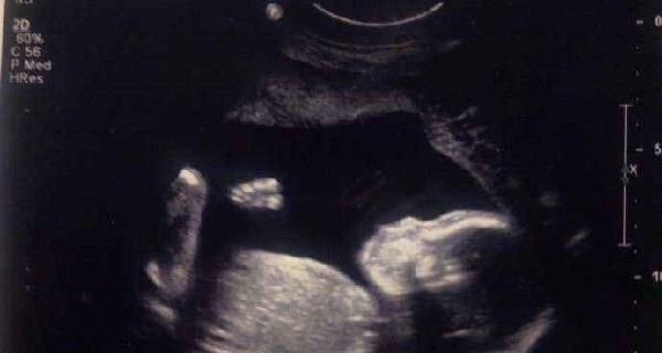 无知|“头胎是来报恩的”,医生力保头胎的原因有4个,大多数人不知道