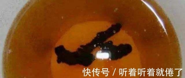 宝妈|广东一名1岁宝宝喝母乳变成哑巴,医生检查原因,宝妈瘫软在地