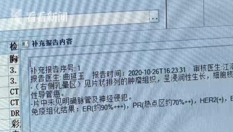 老伯|六旬老伯胸部摸到硬物 一查竟是患上了乳腺癌