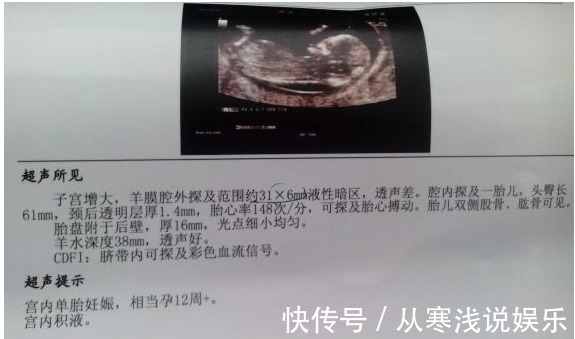 怀孕|怀孕期间,这5项检查能安全通过,说明宝宝健康聪明,准妈可放心