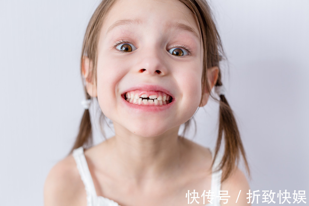 干预|儿童做牙齿矫正三个最佳时间家长要牢记,矫治越早干预效果越好