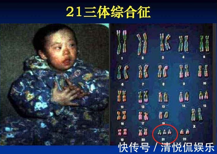 准爸爸|有种产检叫“准爸爸不能缺席”,这5项产检,准爸爸再忙也要来