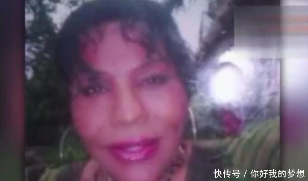 女子花2万元整容,整容失败变成“水泥脸”,看完你还想整容吗?