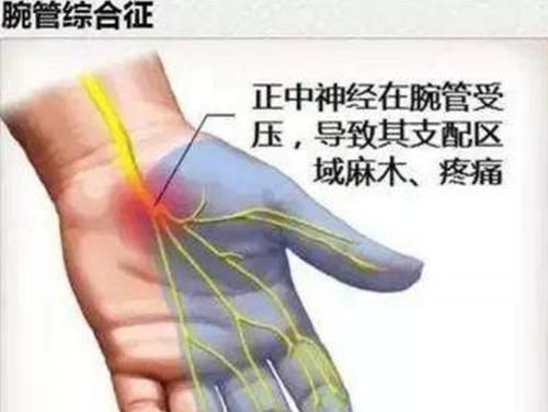 手脚麻木|手脚麻木，是哪里发出的预告？