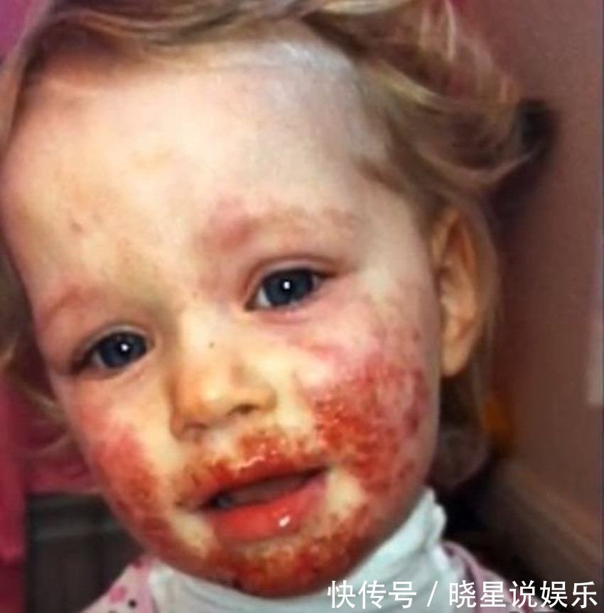 火气|两岁小女孩被男子亲了一口,一个月后妈妈却含泪为娃洗染血的衣服