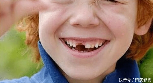 如果用牙齿来判断颜值的话，大家觉得问题容易出现在哪里呢？