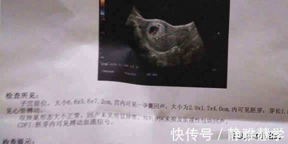 b超|怀孕时,如果准妈妈怀的是女孩,孕检单上一般会有四种提示