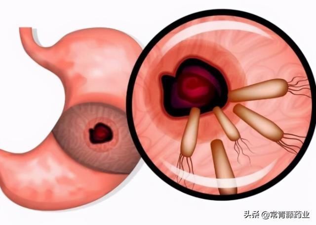 奶奶|喂饭给孩子喂成胃出血！多半是喂食错误，你还这样带孩子吗？