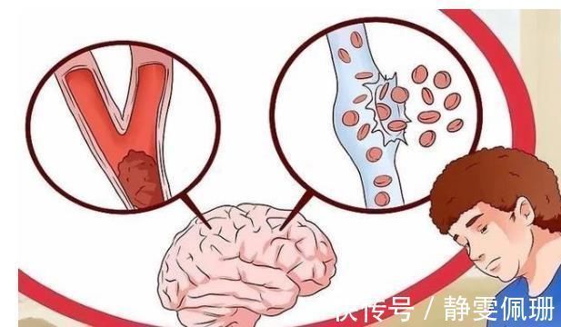 疏通|预防脑梗,睡前经常做这一件事,能够帮你疏通血管,避免中风!