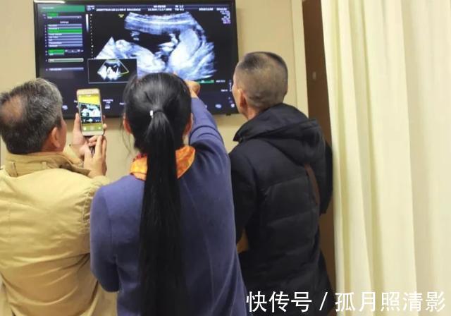 准爸爸|四维检查时为什么都贴着“家属止步”其中的原因,看完就明白了