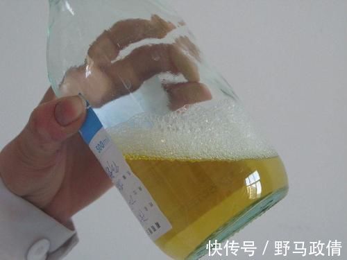 特点|男人晨起后,如果身体有几个特点,说明肾脏很强壮,不妨自测一下