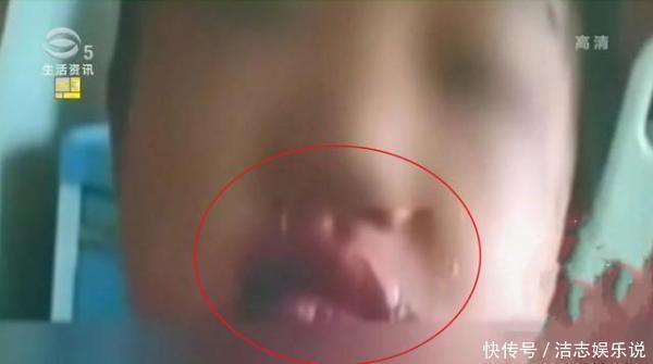 玩具区|4岁女孩玩“七彩泡泡机”，竟把自己玩毁容！家长痛哭就不该买