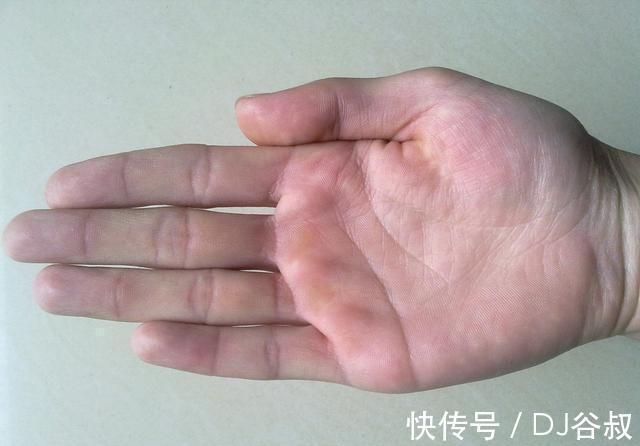 绿茶|你清楚“糖尿病”吗?如何降“血糖”?建议:常吃以下这5种食物