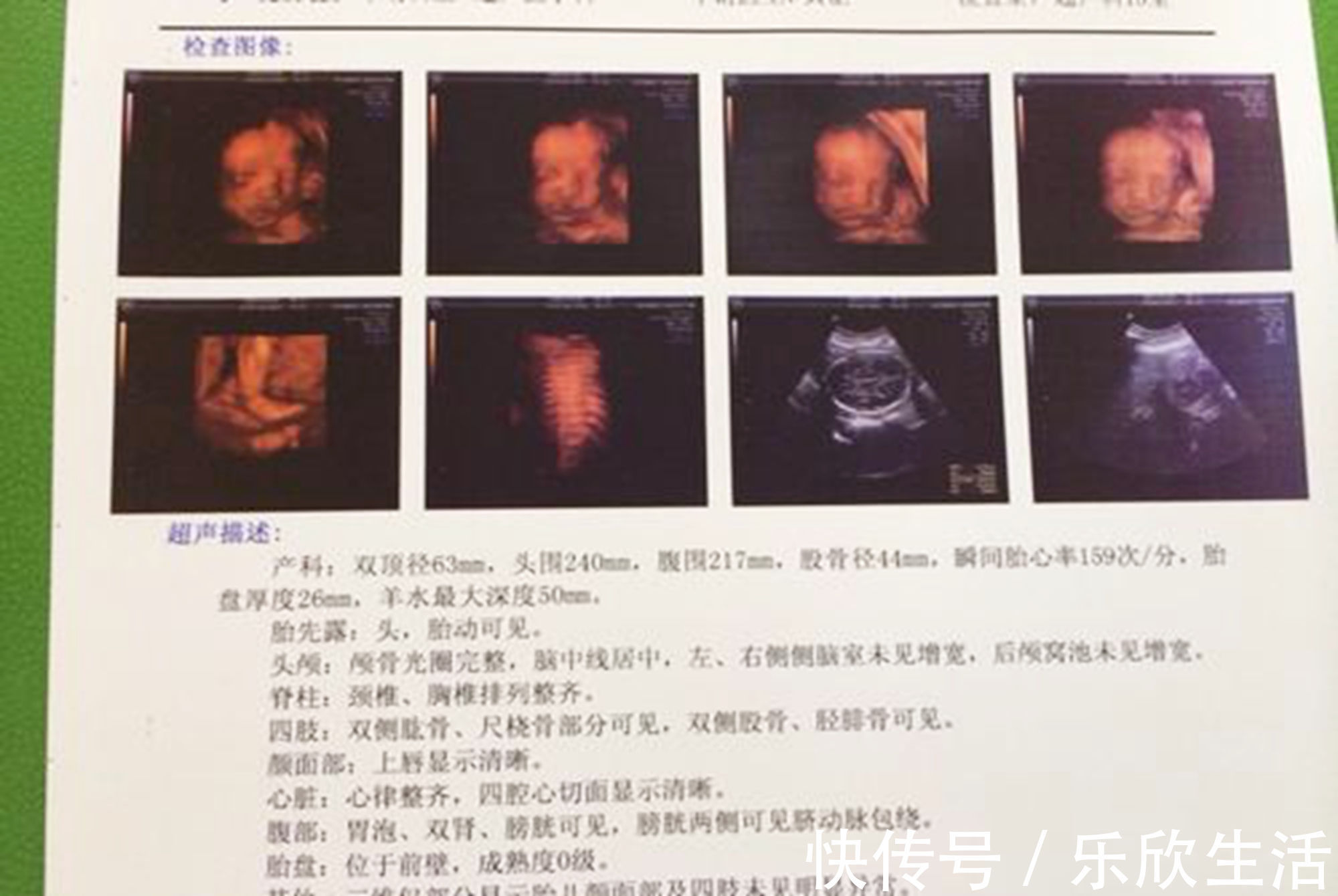 b超|孕早期B超单上的四个指标，暗含了胎儿的“小秘密”，你看得懂吗