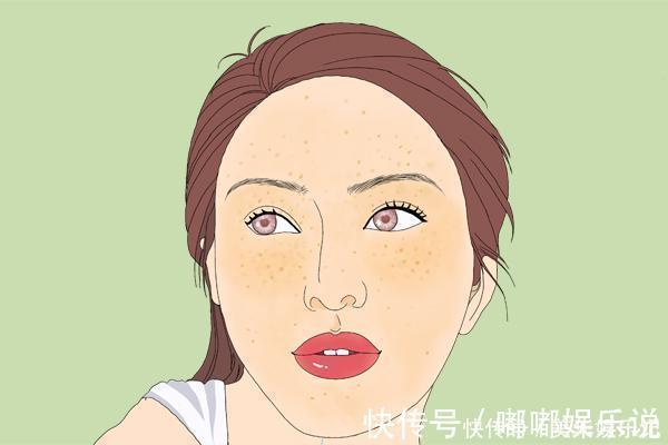 红血丝|肝病会上脸，肝不好的人，脸上通常会有明显的标志，可对照自查