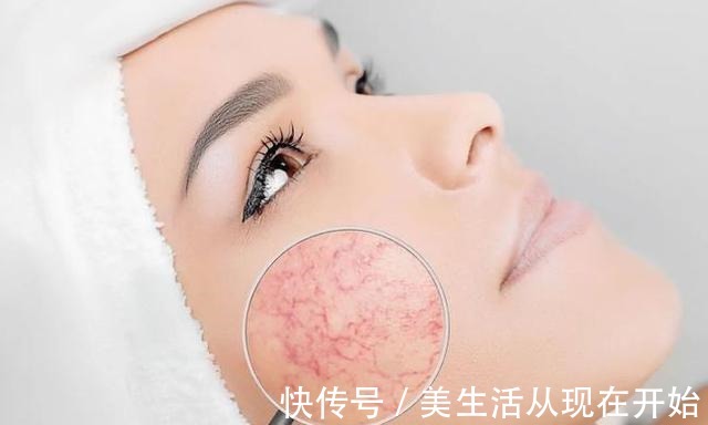 化妆棉 日常护肤有这4个坏习惯,女生皮肤会越来越敏感,你中招了没!