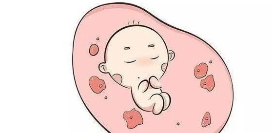 孕妈们|孕妇可以平躺睡觉，主要注意这点就够了