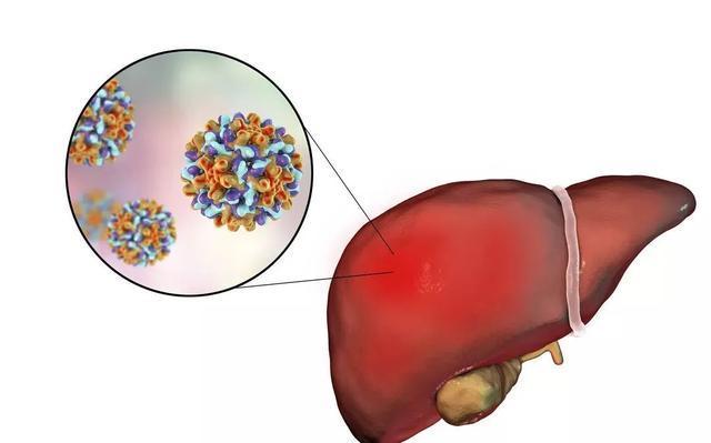 肝细胞|李兰娟院士送给大家的4个养肝建议,常吃这几种早餐助你养护肝脏