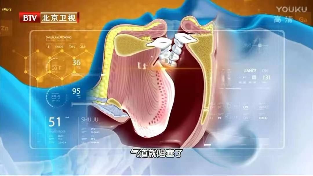 打鼾|颠覆！这10个你认为健康的生活方式，可能害了你……尤其是第4个