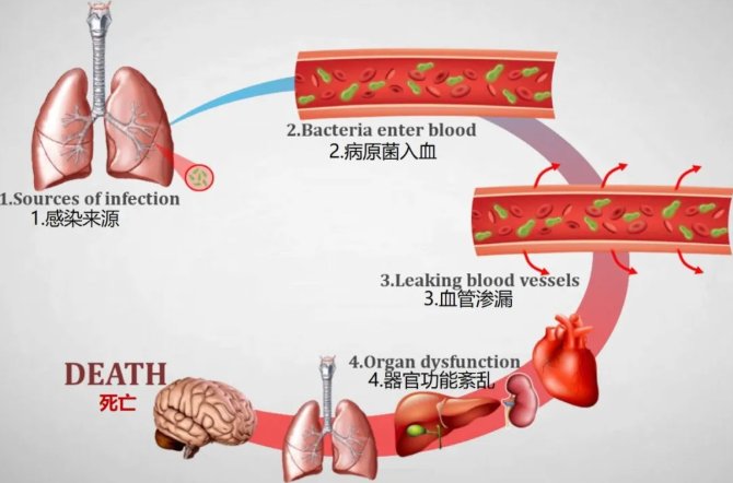 感染|【健哥说心脏】没听过败血症？注意！它也会威胁心血管健康！