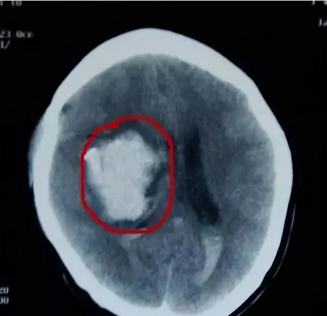孩子|孙子翻身掉床,奶奶一个动作令娃永远离开:摔倒谨记“黄金3步”