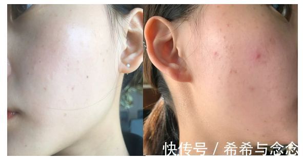 孕妇|护肤品只看品牌不靠谱!孕妇公认的“成分实力派”口碑护肤品牌榜