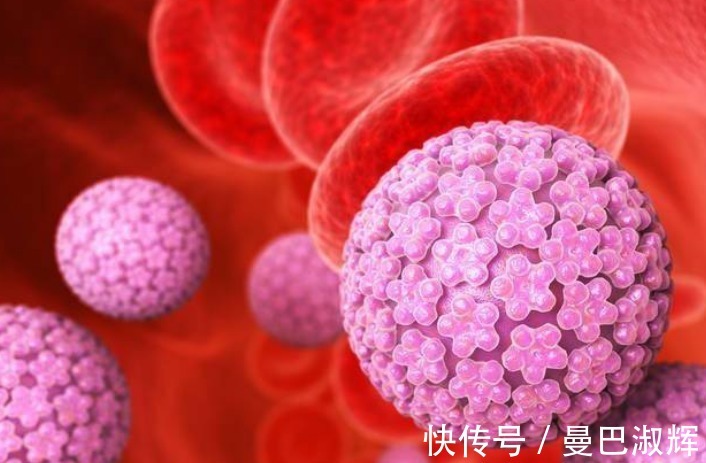 男友|90后情侣双双感染HPV,医生直言,日常2个习惯,劝你戒掉
