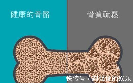 維生素d|要不要出去多曬曬太陽？抗骨質疏松，醫生給你講講曬太陽的秘訣