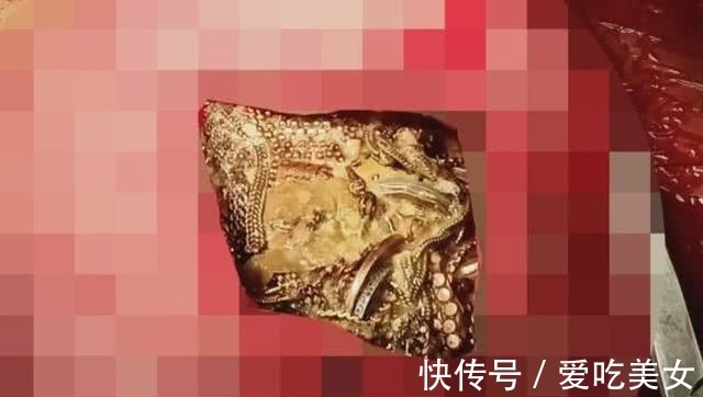 珠宝|印度一女子身体里竟取出价值45万的珠宝:69条链子,80个耳环