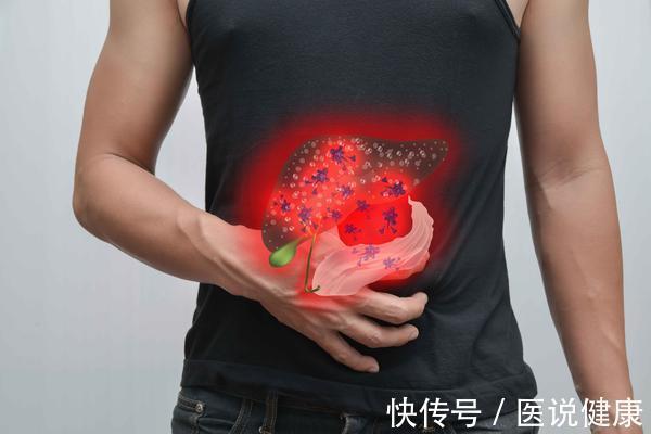 上火|上厕所时,尿液发黄且异味重?或与这5个因素有关,及时检查