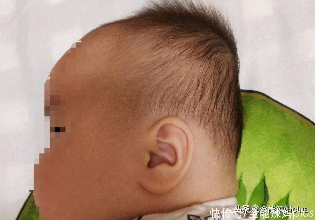 孩子|“妈求求你,别给我睡扁头了”扁头有多毁娃?3张对比图告诉你