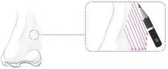 鼻孔@零基础素描教程:分步骤讲解34侧面鼻子画法,简单易学,快临摹