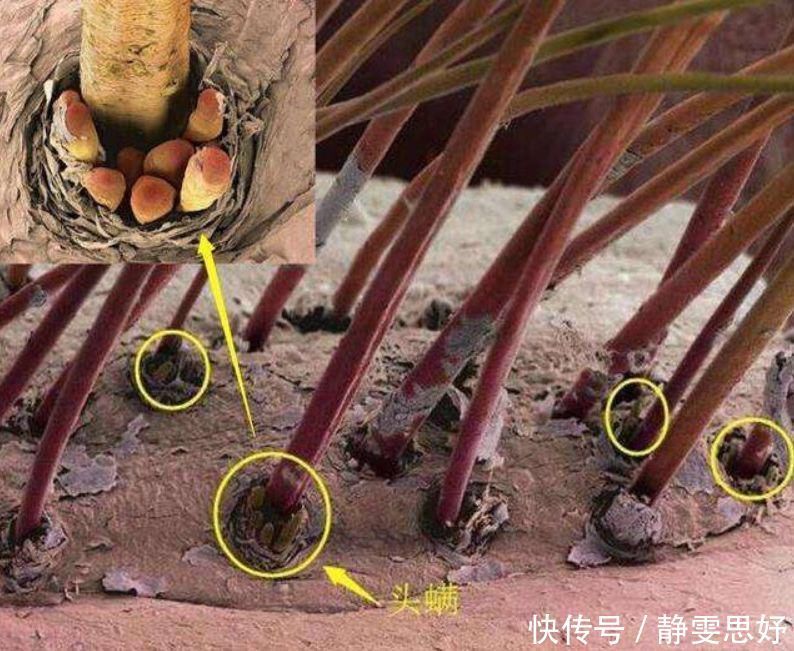 头皮|不想让头发变“大油田”?洗头时戒掉这3习惯,发质或会“越来越好”