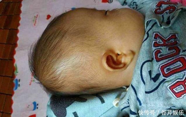 颜值|宝宝睡扁头长大颜值高知道这些影响后,谁再坚持睡跟谁急