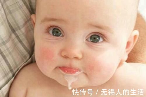 皮屑|新生儿身上5个“不对劲”,其实会自行消失,早点了解不慌张!