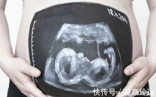 暮沐|孕妈有这三种体验,可能是胎儿“高智商”的表现,早知道早放心!