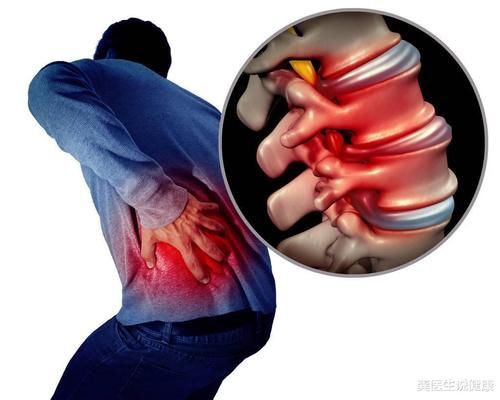 李大姐|早餐“伤骨王”重现,骨科医生:骨量在慢慢流失,不妨试试这1“清洁剂”