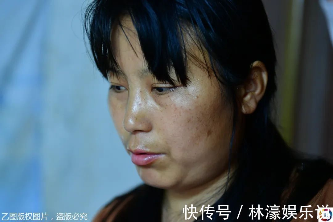 纱布|男童出生患罕见病,三年用掉纱布5000多圈,每天只能坐在床上