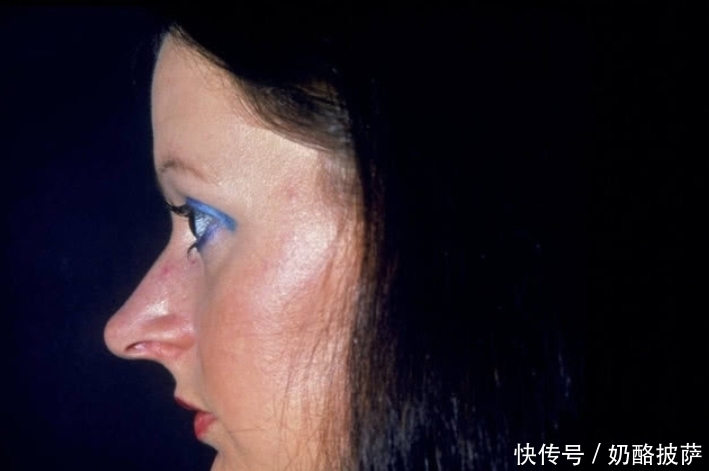 身体|肺好不好,看身体5个表现!远离三烟,多吃三白,肺会慢慢变好