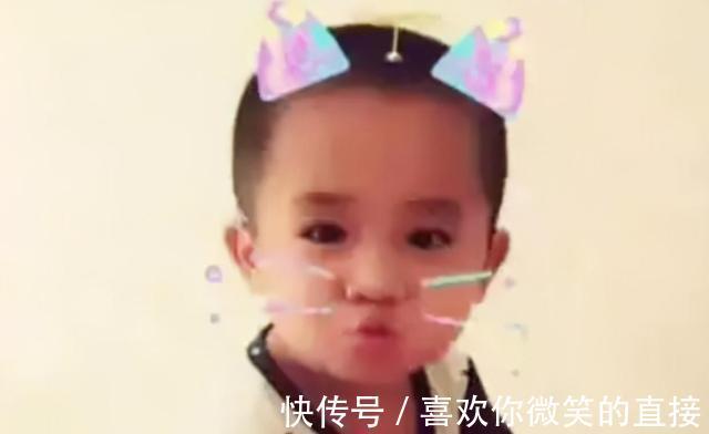 亲人们|5年前因吃奶太用力，被妈妈刮成“花脸猫”的宝宝，如今怎么样了