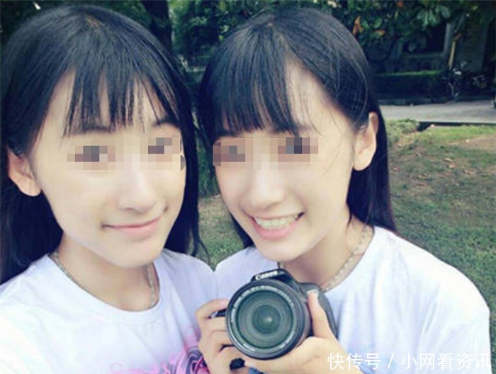 妹妹张珑|连体姐妹做分离手术时,共有器官给了姐姐,10年后妹妹怎么样了