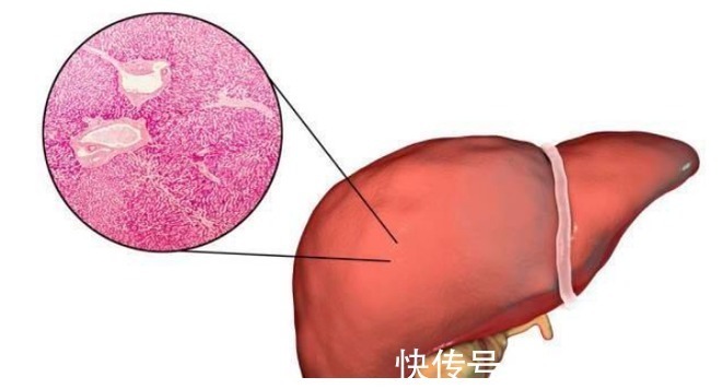 甲状腺结节|很多“病”都不算病，只是上了年纪：这4种疾病，不用太过担心