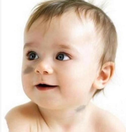 营养不良|宝宝为什么会长胎记?医生:孕期3种行为或易长胎记,建议了解