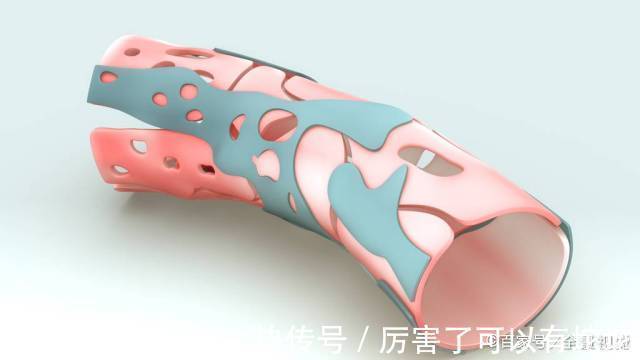 高血脂|高血脂“克星”大公开！坚持做三件事，血管干净，血脂乖乖听话！