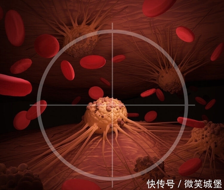 里程碑突破!国产抗癌药闪耀世界大会舞台,可“饿死”多种癌症