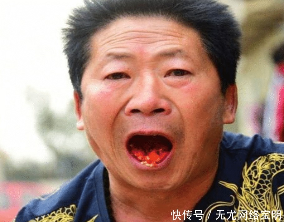 “中国辣王”李永志,不听医生劝,一天5斤辣椒当饭吃,如今咋样